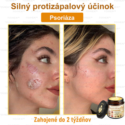 💎🐝💎FOVHEAl™ Krém na pleť s úplným účinkom z včelieho jedu - 🧑‍⚕️Odporúčané dermatológmi - Vhodné pre všetky vekové kategórie