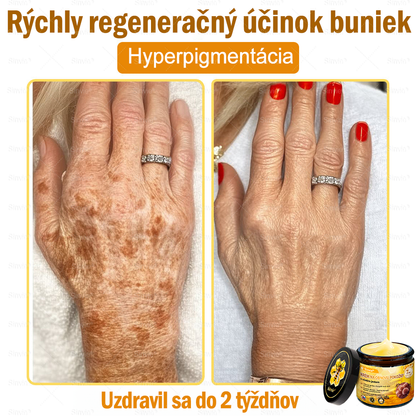 💛Sinvie® Krém na obnovu pokožky s včelím jedom 🔥 Odporúčané dermatológmi | Proti vráskam, pigmentovým škvrnám a ochabnutej pokožke – 50 ml