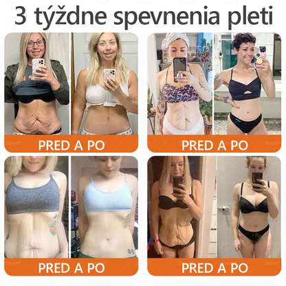 💛Sinvie® Krém na obnovu pokožky s včelím jedom 🔥 Odporúčané dermatológmi | Proti vráskam, pigmentovým škvrnám a ochabnutej pokožke – 50 ml