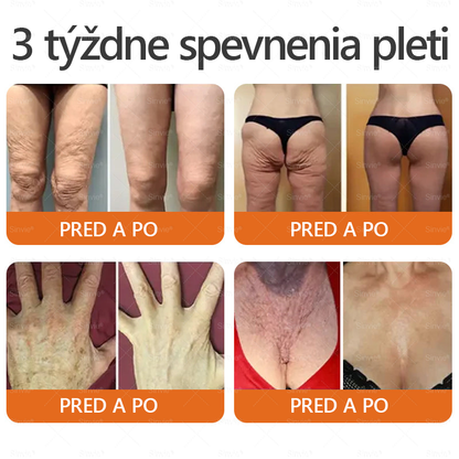 💛Sinvie® Krém na obnovu pokožky s včelím jedom 🔥 Odporúčané dermatológmi | Proti vráskam, pigmentovým škvrnám a ochabnutej pokožke – 50 ml