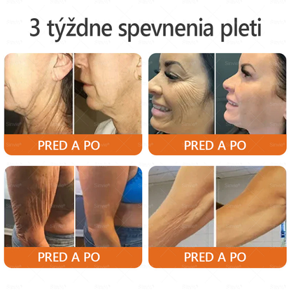 💛Sinvie® Krém na obnovu pokožky s včelím jedom 🔥 Odporúčané dermatológmi | Proti vráskam, pigmentovým škvrnám a ochabnutej pokožke – 50 ml