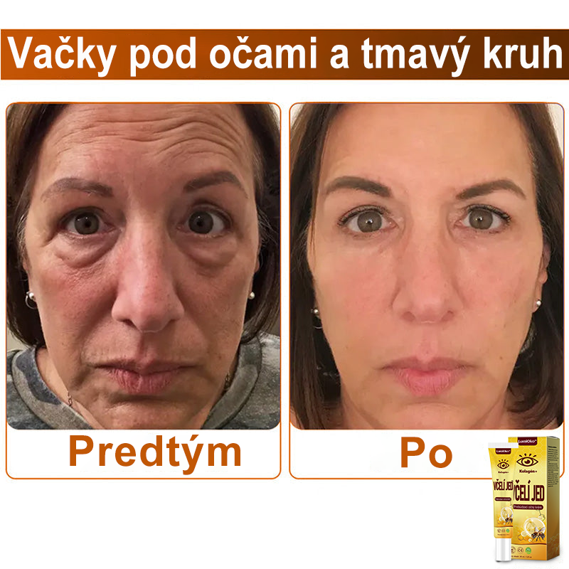 💛LumiOko™ Kolagén+ Včelí Jed Prebúdzací Očný Krém - Odporúčané dermatológom - Získalo certifikát CE