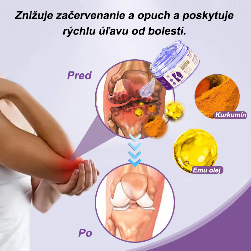 🪻Viloxera™ Kurkuma a Emu Olej Masážny gél proti bolesti kĺbov👨‍⚕️Schválené Slovenskou ortopedickou spoločnosťou (SOTS)