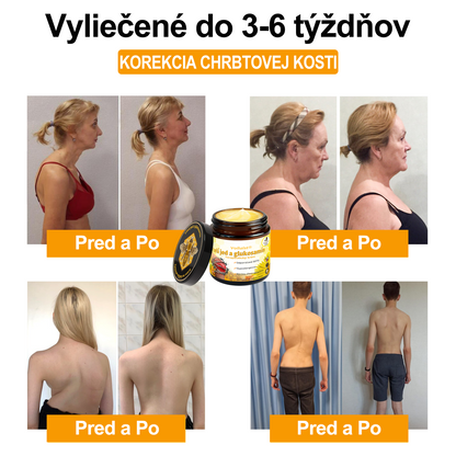 ✨🐝✨Voilaist® Terapeutický krém s včelím jedom a glukozamínom - Určené pre ľudí v strednom a staršom veku