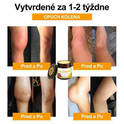✨🐝✨Voilaist® Terapeutický krém s včelím jedom a glukozamínom - Určené pre ľudí v strednom a staršom veku
