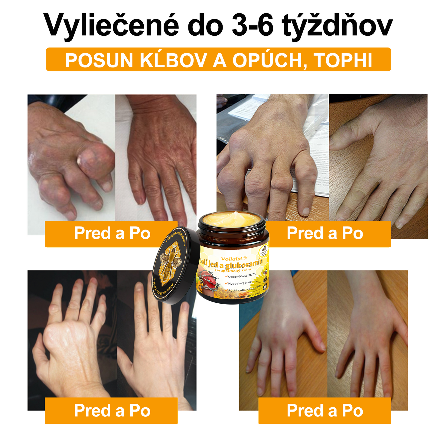✨🐝✨Voilaist® Terapeutický krém s včelím jedom a glukozamínom - Určené pre ľudí v strednom a staršom veku