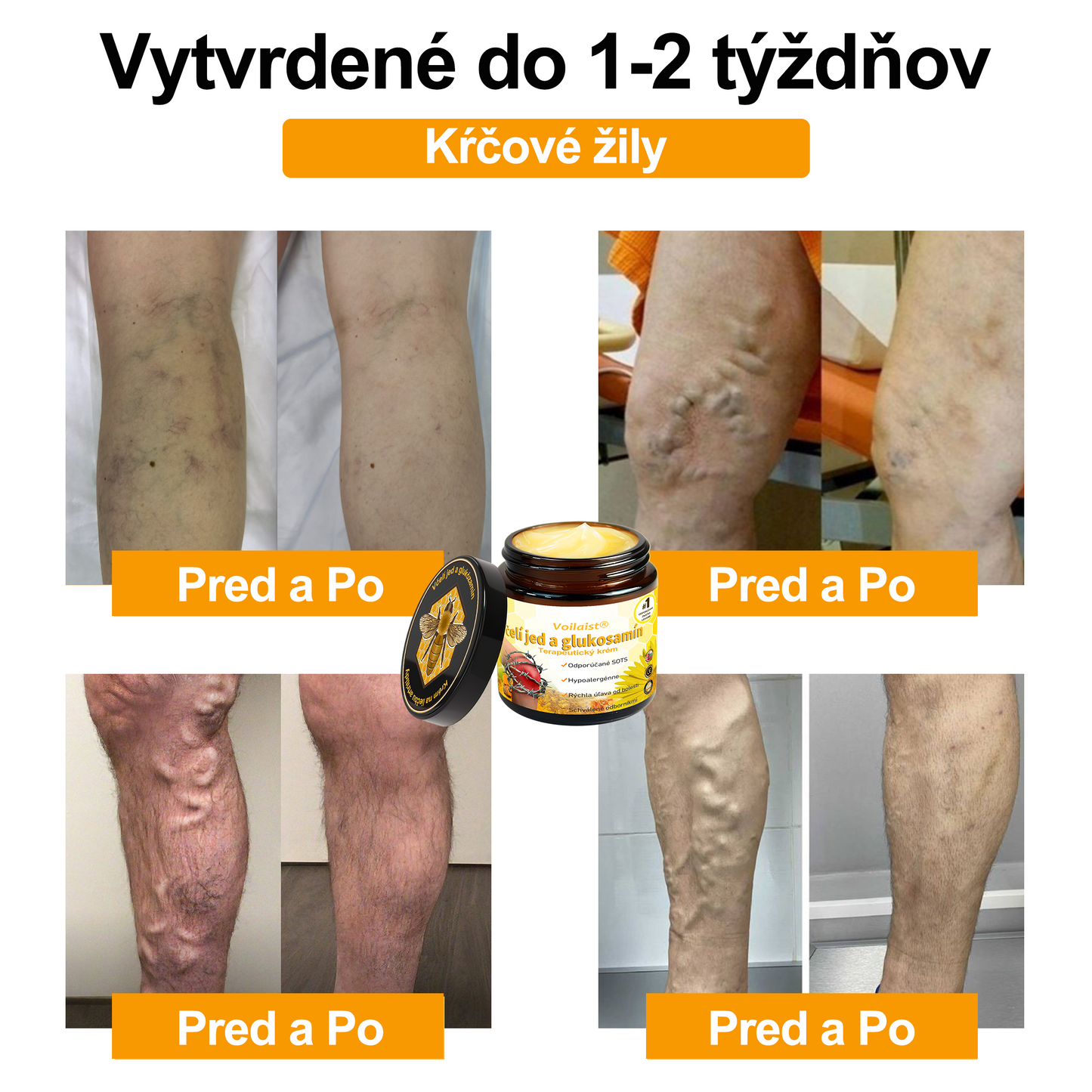 ✨🐝✨Voilaist® Terapeutický krém s včelím jedom a glukozamínom - Určené pre ľudí v strednom a staršom veku