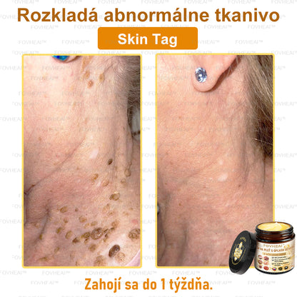 💎🐝💎FOVHEAl™ Krém na pleť s úplným účinkom z včelieho jedu - 🧑‍⚕️Odporúčané dermatológmi - Vhodné pre všetky vekové kategórie