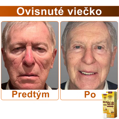 💛LumiOko™ Kolagén+ Včelí Jed Prebúdzací Očný Krém - Odporúčané dermatológom - Získalo certifikát CE