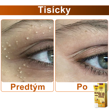 💛LumiOko™ Kolagén+ Včelí Jed Prebúdzací Očný Krém - Odporúčané dermatológom - Získalo certifikát CE