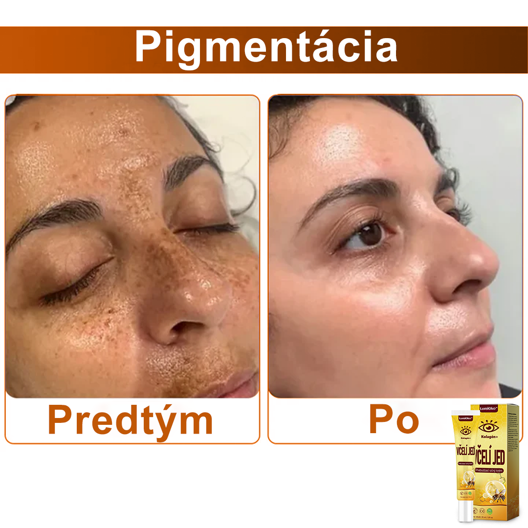 💛LumiOko™ Kolagén+ Včelí Jed Prebúdzací Očný Krém - Odporúčané dermatológom - Získalo certifikát CE