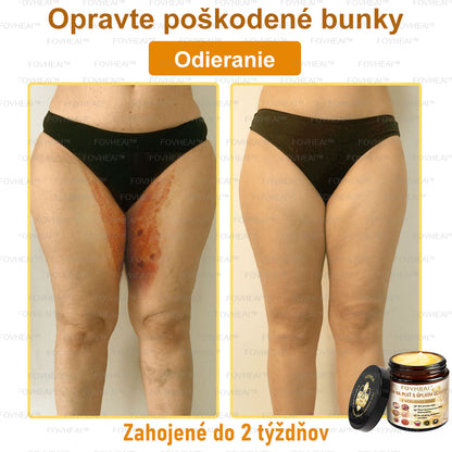 💎🐝💎FOVHEAl™ Krém na pleť s úplným účinkom z včelieho jedu - 🧑‍⚕️Odporúčané dermatológmi - Vhodné pre všetky vekové kategórie