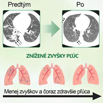 🌿𝐆𝐨𝐨𝐲𝐞𝐞𝐫™ Vysoko kvalitný pľúcny sprej -🧑‍⚕️ Podporuje zdravie pľúc, priedušiek a dutín, podporuje zdravie dýchacieho systému a ľahšie dýchanie
