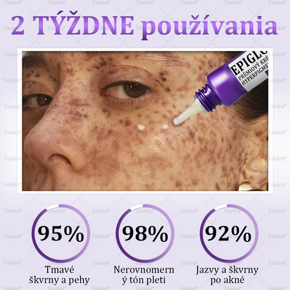 🪻Tavlira® EPIGLOW MelanEX Prémiový krém proti hyperpigmentácii | ✅Schválené zdravotníckym oddelením Slovenska