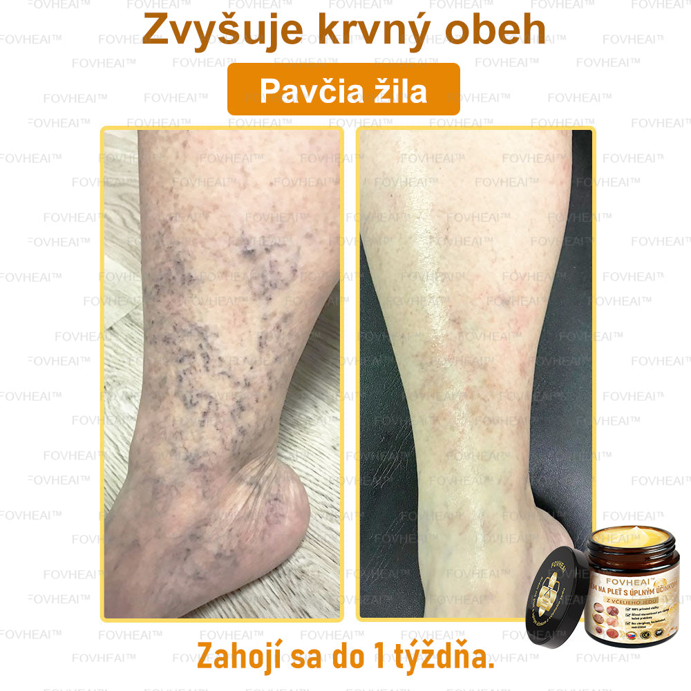 💎🐝💎FOVHEAl™ Krém na pleť s úplným účinkom z včelieho jedu - 🧑‍⚕️Odporúčané dermatológmi - Vhodné pre všetky vekové kategórie