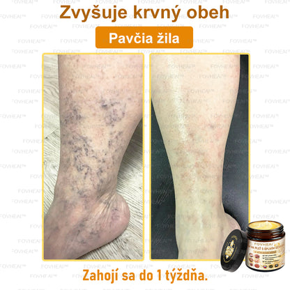 💎🐝💎FOVHEAl™ Krém na pleť s úplným účinkom z včelieho jedu - 🧑‍⚕️Odporúčané dermatológmi - Vhodné pre všetky vekové kategórie
