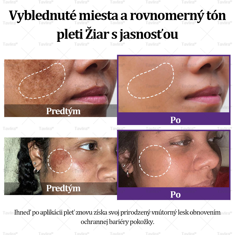 🪻Tavlira® EPIGLOW MelanEX Prémiový krém proti hyperpigmentácii | ✅Schválené zdravotníckym oddelením Slovenska
