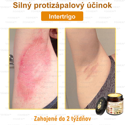 💎🐝💎FOVHEAl™ Krém na pleť s úplným účinkom z včelieho jedu - 🧑‍⚕️Odporúčané dermatológmi - Vhodné pre všetky vekové kategórie