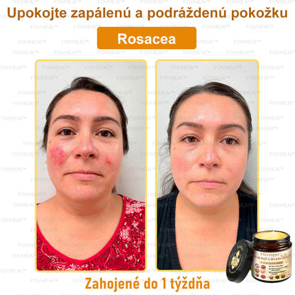 💎🐝💎FOVHEAl™ Krém na pleť s úplným účinkom z včelieho jedu - 🧑‍⚕️Odporúčané dermatológmi - Vhodné pre všetky vekové kategórie