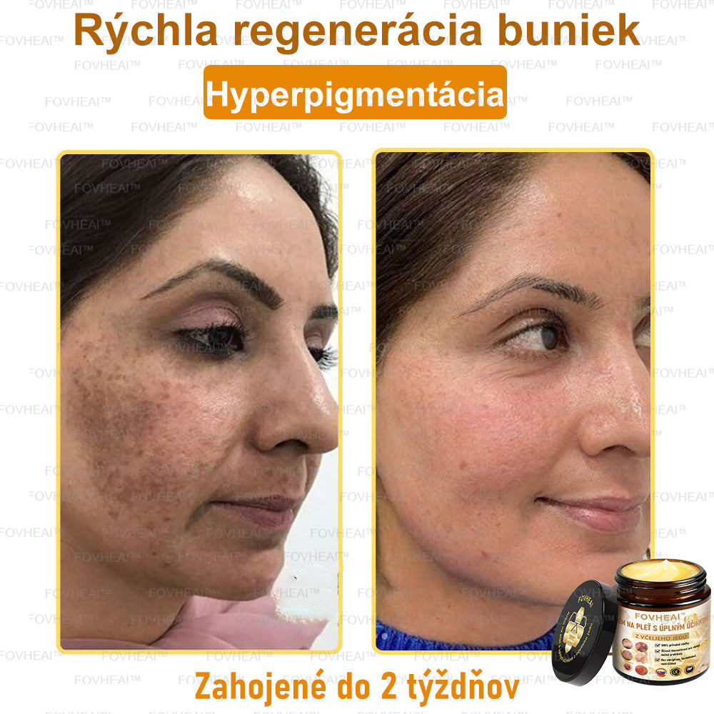 💎🐝💎FOVHEAl™ Krém na pleť s úplným účinkom z včelieho jedu - 🧑‍⚕️Odporúčané dermatológmi - Vhodné pre všetky vekové kategórie