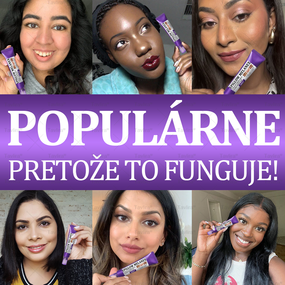 🪻Tavlira® EPIGLOW MelanEX Prémiový krém proti hyperpigmentácii | ✅Schválené zdravotníckym oddelením Slovenska