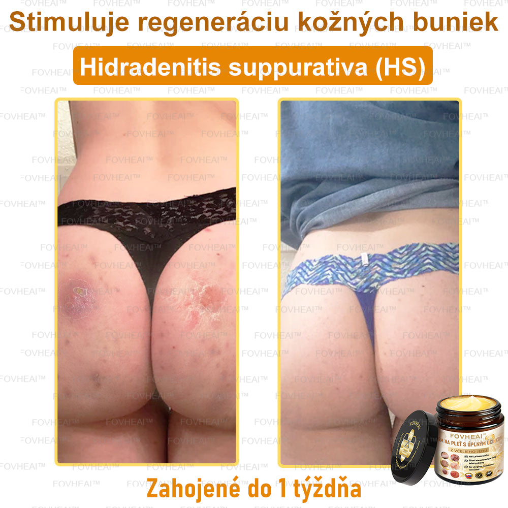 💎🐝💎FOVHEAl™ Krém na pleť s úplným účinkom z včelieho jedu - 🧑‍⚕️Odporúčané dermatológmi - Vhodné pre všetky vekové kategórie