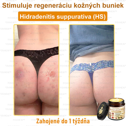 💎🐝💎FOVHEAl™ Krém na pleť s úplným účinkom z včelieho jedu - 🧑‍⚕️Odporúčané dermatológmi - Vhodné pre všetky vekové kategórie