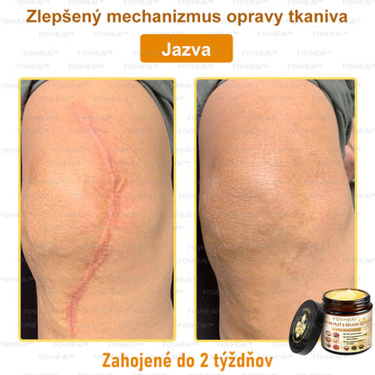 💎🐝💎FOVHEAl™ Krém na pleť s úplným účinkom z včelieho jedu - 🧑‍⚕️Odporúčané dermatológmi - Vhodné pre všetky vekové kategórie